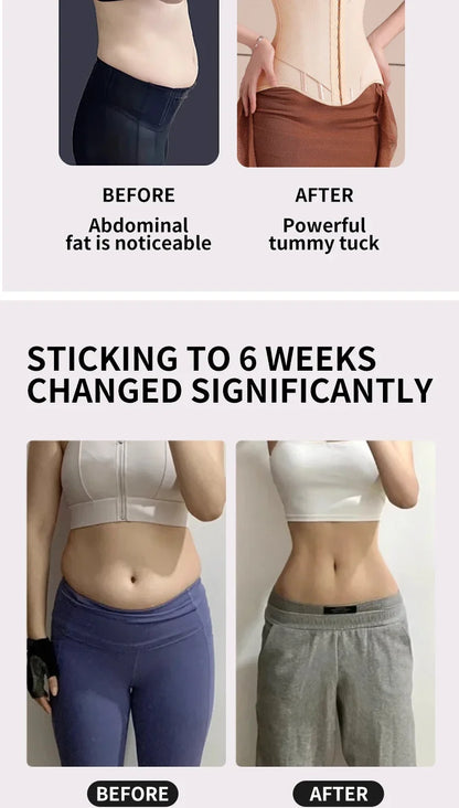 U-shaped Waist Trainer Corset Women Buttoned Shapers Breast Lifted Waist Trainer Steel Bone Slimming Women's Shapewear