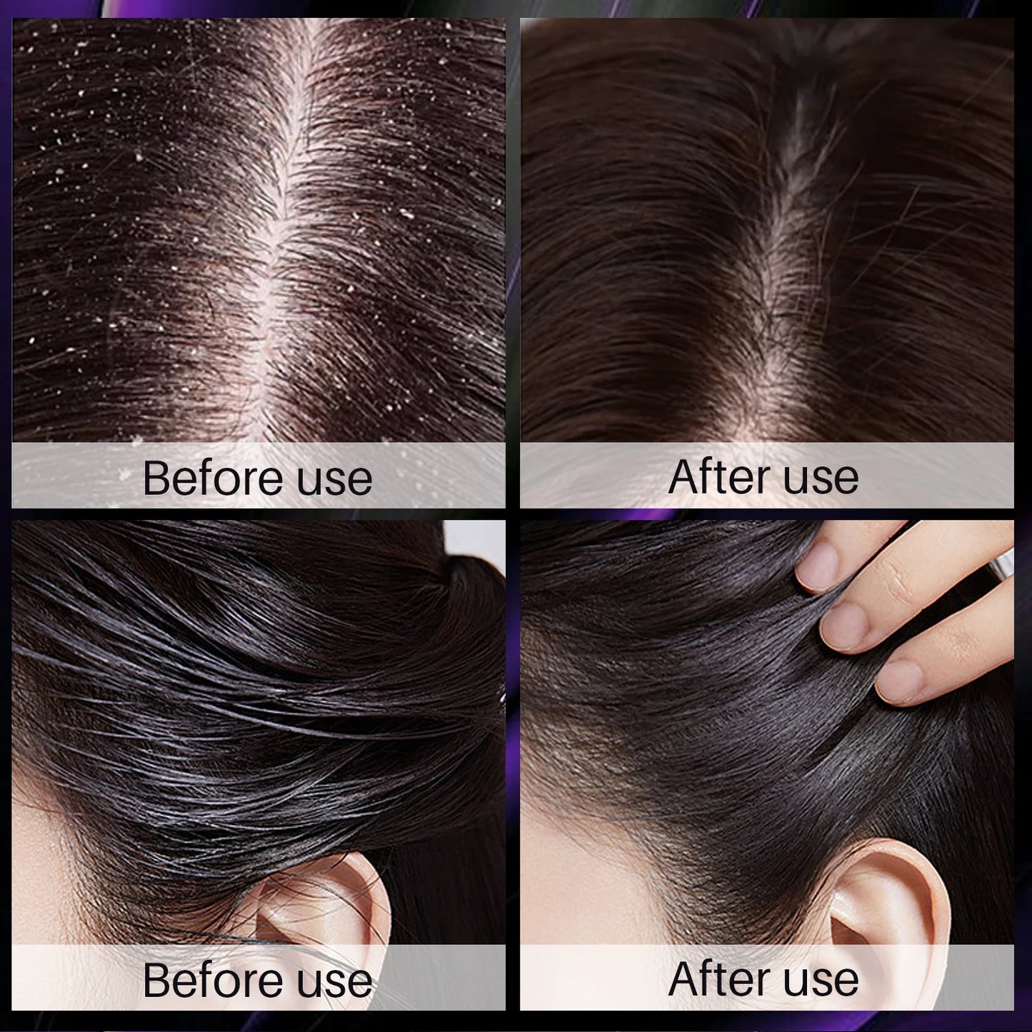 Hair Shampoo For Fast Hair Growth Rosemary Onion Shampoo 30ML Spray Anti Hair Loss Effective Within 7 Day Hair Growth