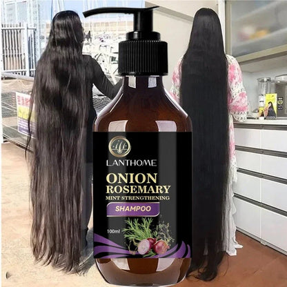 Hair Shampoo For Fast Hair Growth Rosemary Onion Shampoo 30ML Spray Anti Hair Loss Effective Within 7 Day Hair Growth - Japan 4 All