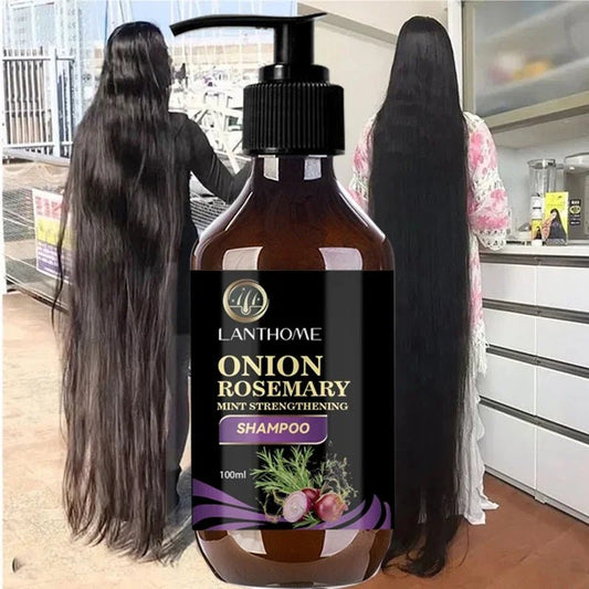 Hair Shampoo For Fast Hair Growth Rosemary Onion Shampoo 30ML Spray Anti Hair Loss Effective Within 7 Day Hair Growth - Japan 4 All